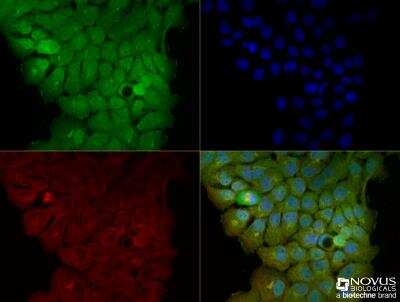 Immunocytochemistry/Immunofluorescence: CD133 Antibody [NBP2-44248] - A431 cells were fixed for 10 minutes using 10% formalin and then permeabilized for 5 minutes using 1X TBS + 0.5% Triton-X100. The cells were incubated with anti-hCD133 at a 1:50 dilution overnight at 4C and detected with and anti-rabbit Dylight 488 (Green) at a 1:500 dilution. Alpha tubulin was used as a co-stain at a 1:1000 dilution and detected with and anti-mouse Dylight 550 (Red) at a 1:500 dilution. Nuclei were counterstained with DAPI (Blue). Cells were imaged using a 40X objective.