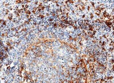 Immunohistochemistry-Paraffin: CD14 Antibody (001) [NBP2-89259] - Staining of human CD14 in human tonsil with rabbit monoclonal antibody (1:200).
