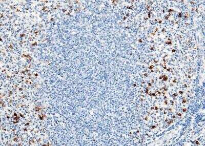 Immunohistochemistry-Paraffin: CD14 Antibody (001) [NBP2-89259] - Staining of human CD14 in human spleen with rabbit monoclonal antibody (1:200).