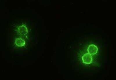 Immunocytochemistry/Immunofluorescence: CD14 Antibody (503) [NBP2-90362] - Staining of Mouse CD14 in Mouse Spleen cells. Cells were fixed with 4% PFA, blocked with 10% serum, and incubated with rabbit anti-mouse CD14 monoclonal antibody (1:60) at 37? 1 hour. Then cells were stained with the Alexa Fluor® 488-conjugated Goat Anti-rabbit IgG secondary antibody (green). Positive staining was localized to cell membrane.