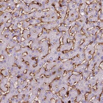 Immunohistochemistry-Paraffin: CD14 Antibody (CL1637) [NBP2-34485] - Staining of human liver shows moderate to strong membranous positivity in Kupffer cells.