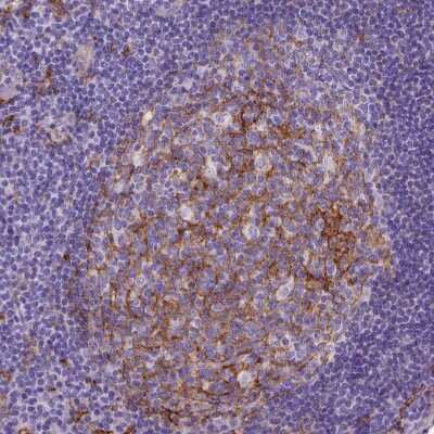 Immunohistochemistry-Paraffin: CD14 Antibody (CL1637) [NBP2-34485] - Staining of human tonsil shows moderate to strong membranous positivity in germinal center cells.
