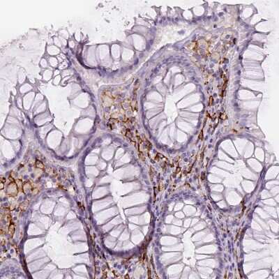 Immunohistochemistry-Paraffin: CD14 Antibody (CL1637) [NBP2-34485] - Staining of human rectum shows moderate to strong membranous positivity in lymphoid cells.