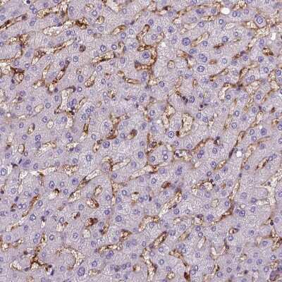 <b>Orthogonal Strategies Validation. </b>Immunohistochemistry-Paraffin: CD14 Antibody (CL1638) [NBP2-34486] - Staining of human liver shows moderate membranous positivity in Kupffer cells.