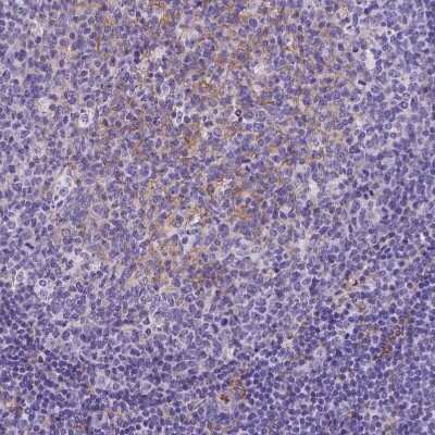 Immunohistochemistry-Paraffin: CD14 Antibody (CL1638) [NBP2-34486] - Staining of human tonsil shows moderate membranous positivity, mainly in germinal center cells.