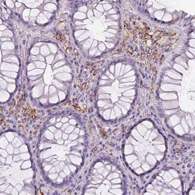 Immunohistochemistry-Paraffin: CD14 Antibody (CL1638) [NBP2-34486] - Staining of human rectum shows moderate membranous positivity in lymphoid cells.