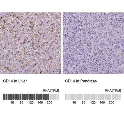 Immunohistochemistry-Paraffin: CD14 Antibody (CL1638) [NBP2-34486] - Staining in human liver and pancreas tissues. Corresponding CD14 RNA-seq data are presented for the same tissues.