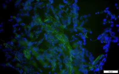 Immunohistochemistry-Frozen: CD14 Antibody (M5E2) [Alexa Fluor 488] [NB100-77758AF488] - Human lung tissue was stained with FITC-conjugated CD14 (Green) for overnight.