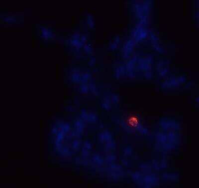 Immunohistochemistry-Frozen: CD14 Antibody (M5E2) [Alexa Fluor 647] [NB100-77758AF647] - Representative immunostaining of CD14 (red) in adult human lung tissue sample with nuclei counterstained blue. This image was submitted by customer review. 