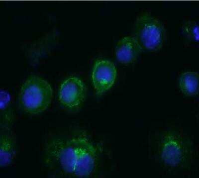 Immunocytochemistry/Immunofluorescence: CD14 Antibody (Sa14-2) [NBP1-51121] - RAW264.7 cells were grown on coverslips, fixed with 1% parformaldehyde and blocked with BSA. As primary antibody was used at 2 ug/ml in PBS/BSA 3%.