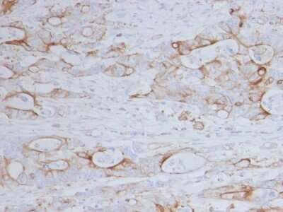 Immunohistochemistry-Paraffin: CD151 Antibody (11G5a) - Azide and BSA Free [NBP3-08797] - Formalin-fixed, paraffin-embedded human colon stained with CD151 Mouse Monoclonal Antibody (11G5a).