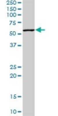 Western Blot: CD155/PVR Antibody [H00005817-D01P] - Analysis of PVR expression in mouse stomach.