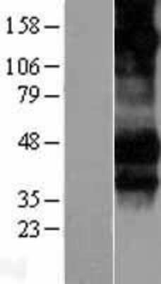 Western Blot Fc gamma RIIIA/CD16a Overexpression Lysate