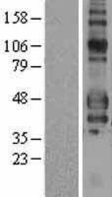 Western Blot Fc gamma RIIIA/CD16a Overexpression Lysate