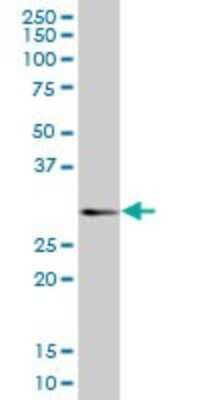 Western Blot: CD160 Antibody [H00011126-B01P] - Analysis of CD160 expression in human spleen.