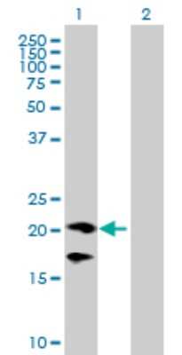 Western Blot: CD160 Antibody [H00011126-B01P] - Analysis of CD160 expression in transfected 293T cell line by CD160 polyclonal antibody.  Lane 1: CD160 transfected lysate(19.91 KDa). Lane 2: Non-transfected lysate.