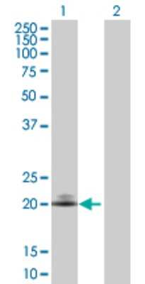 Western Blot: CD160 Antibody [H00011126-D01P] - Analysis of CD160 expression in transfected 293T cell line by CD160 polyclonal antibody.Lane 1: CD160 transfected lysate(19.80 KDa).Lane 2: Non-transfected lysate.