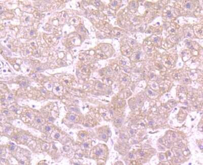 Immunohistochemistry-Paraffin: CD163 Antibody (JA51-30) [NBP2-67224] - Analysis of paraffin-embedded human liver tissue using anti-CD163 antibody. Counter stained with hematoxylin.