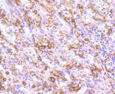 Immunohistochemistry-Paraffin: CD163 Antibody (JA51-30) [NBP2-67224] - Analysis of paraffin-embedded human spleen tissue using anti-CD163 antibody. Counter stained with hematoxylin.