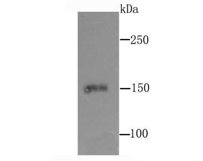Western Blot: CD163 Antibody (JA51-30) [NBP2-67224] - Analysis of CD163 on human thymus tissue lysate using anti-CD163 antibody at 1/1,000 dilution.