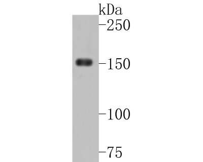 Western Blot: CD163 Antibody (JA51-30) [NBP2-67224] - Western blot analysis of CD163 on human thymus tissue lysates. Proteins were transferred to a PVDF membrane and blocked with 5% BSA in PBS for 1 hour at room temperature. The primary antibody (1/500) was used in 5% BSA at room temperature for 2 hours. Goat Anti-Rabbit IgG - HRP Secondary Antibody (HA1001) at 1:5,000 dilution was used for 1 hour at room temperature.