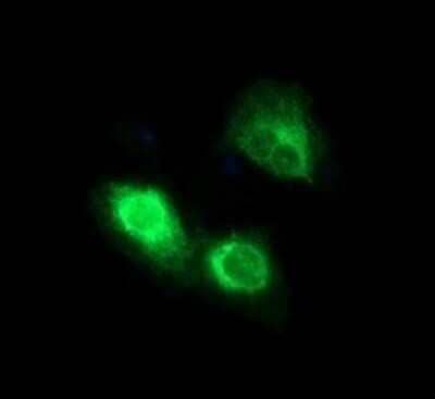 Immunocytochemistry/Immunofluorescence: CD163 Antibody (OTI2B12) - Azide and BSA Free [NBP2-71420] - Analysis of COS7 cells transiently transfected by pCMV6-ENTRY CD163.