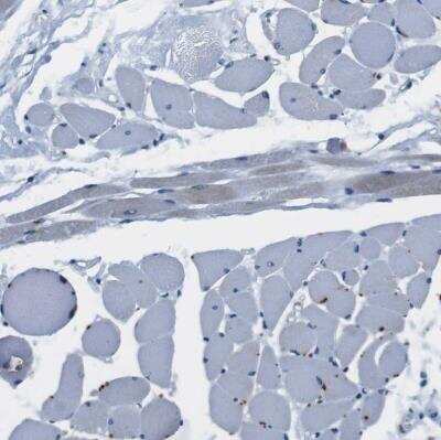 Immunohistochemistry-Paraffin: CD163L1 Antibody [NBP1-86545] - Staining of human skeletal muscle shows no positivity in myocytes as expected.