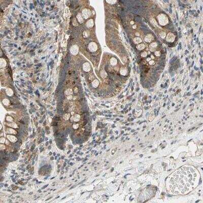 Immunohistochemistry-Paraffin: CD164 Antibody [NBP1-81159] - Staining of human small intestine shows moderate cytoplasmic positivity in glandular cells.