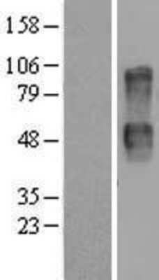 Western Blot: CD164 Overexpression Lysate (Adult Normal) [NBP2-07671] Left-Empty vector transfected control cell lysate (HEK293 cell lysate); Right -Over-expression Lysate for CD164.