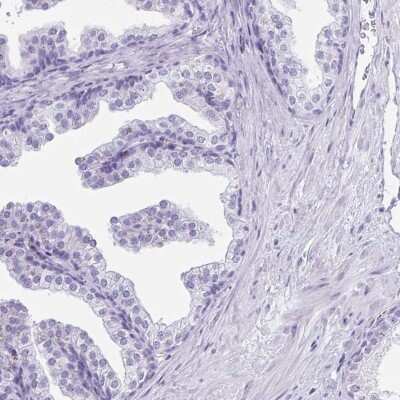 Immunohistochemistry-Paraffin: CD164L2 Antibody [NBP2-38010] - Staining of human prostate shows low expression as expected.