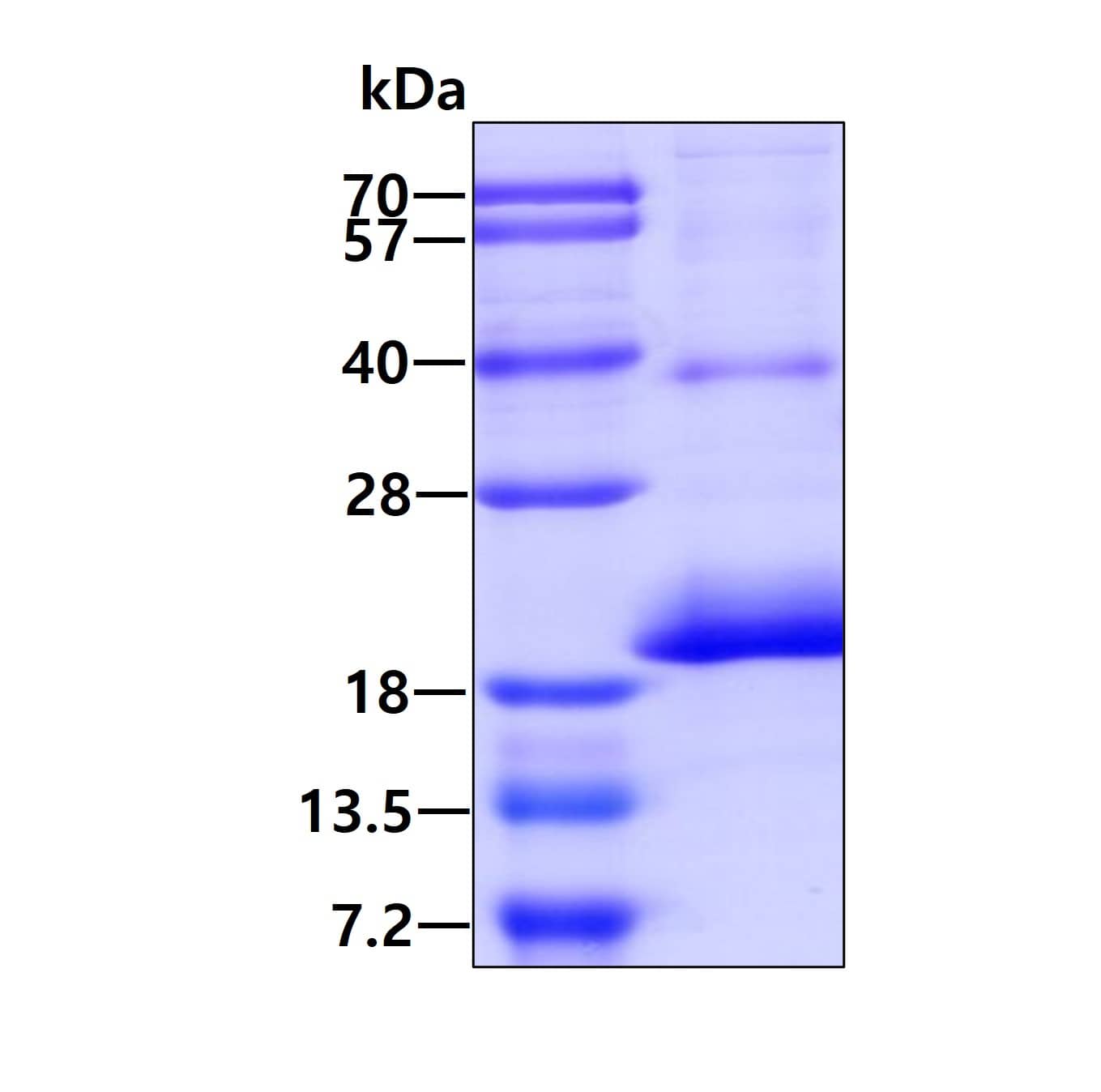 SDS-Page: CD164L2 Recombinant Protein [NBP2-51604] - 3ug by SDS-PAGE under reducing condition and visualized by coomassie blue stain.