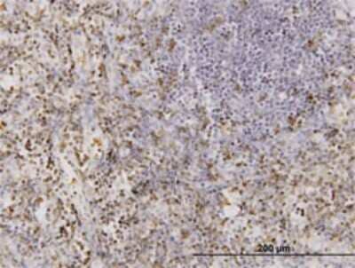 Immunohistochemistry-Paraffin: CD177 Antibody (4C4) [H00057126-M01] - Analysis of monoclonal antibody to CD177 on formalin-fixed paraffin-embedded human lymph node. Antibody concentration 3 ug/ml.