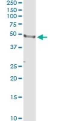 Immunoprecipitation: CD177 Antibody (4C4) [H00057126-M01] - Analysis of CD177 transfected lysate using anti-CD177 monoclonal antibody and Protein A Magnetic Bead, and immunoblotted with CD177 MaxPab rabbit polyclonal antibody.