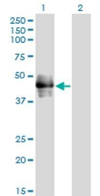 Western Blot: CD177 Antibody (4C4) [H00057126-M01] - Analysis of CD177 expression in transfected 293T cell line by CD177 monoclonal antibody (M01), clone 4C4.Lane 1: CD177 transfected lysate(46.4 KDa).Lane 2: Non-transfected lysate.