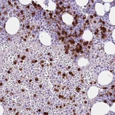 Immunohistochemistry-Paraffin: CD177 Antibody [NBP2-58540] - Staining of human bone marrow shows high expression.