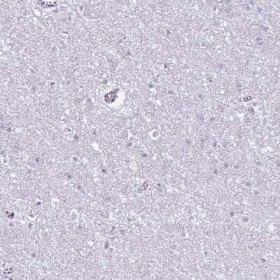 Immunohistochemistry-Paraffin: CD177 Antibody [NBP2-58540] - Staining of human cerebral cortex shows low expression as expected.