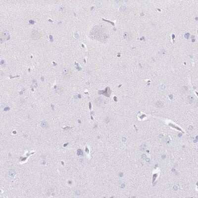 <b>Orthogonal Strategies Validation. </b>Immunohistochemistry-Paraffin: CD177 Antibody [NBP2-58979] - Staining of human cerebral cortex shows low expression as expected.