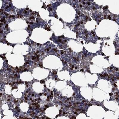 Immunohistochemistry-Paraffin: CD177 Antibody [NBP3-17011] - Staining of human bone marrow shows high expression.