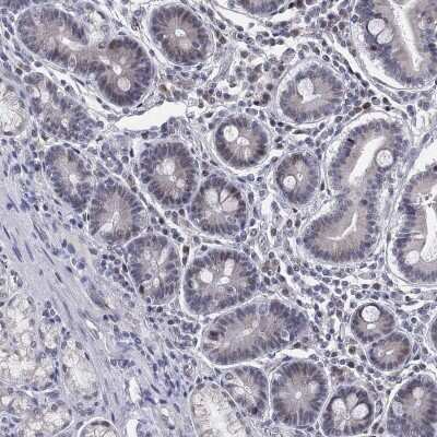 Immunohistochemistry-Paraffin: CD177 Antibody [NBP3-17011] - Staining of human duodenum shows low expression as expected.