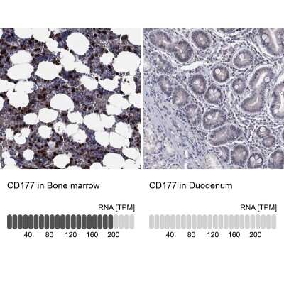 Immunohistochemistry-Paraffin: CD177 Antibody [NBP3-17011] - Analysis in human bone marrow and duodenum tissues using Anti-CD177 antibody. Corresponding CD177 RNA-seq data are presented for the same tissues.