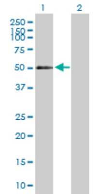 Western Blot: CD177 Antibody [H00057126-D01P] - Analysis of CD177 expression in transfected 293T cell line by CD177 polyclonal antibody.Lane 1: CD177 transfected lysate(46.40 KDa).Lane 2: Non-transfected lysate.