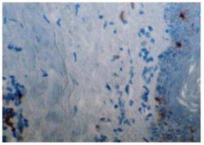 Immunohistochemistry: CD1a Antibody (214A9.01) [DDX0080P-100] - Human skin cryosection stained with 214A9