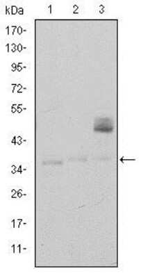 Western Blot: CD1a Antibody (7A7) [NBP2-37622] - Western blot analysis using CD1A mouse mAb against K562 (1), RAJI (2), and MOLT4 (3) cell lysate.