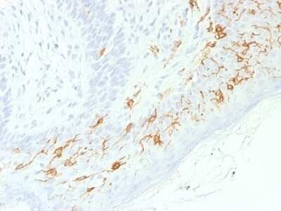 Immunohistochemistry-Paraffin: CD1a Antibody (C1A/1506R) - Azide and BSA Free [NBP2-54547] - Formalin-fixed, paraffin-embedded human Skin stained with CD1a Recombinant Rabbit Monoclonal Antibody (C1A/1506R).