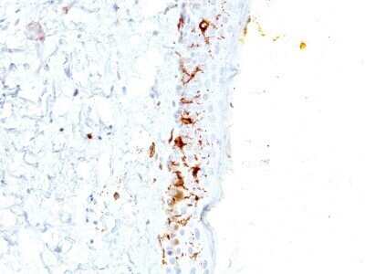 Immunohistochemistry-Paraffin: CD1a Antibody (C1A/711) - IHC-Prediluted [NBP2-45343] - Formalin-fixed, paraffin-embedded human human skin stained with CD1a MAb (C1A/711).