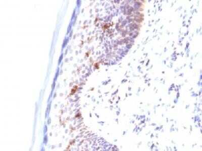 Immunohistochemistry-Paraffin: CD1a Antibody (C1A/711) - IHC-Prediluted [NBP2-45343] - Formalin-fixed paraffin-embedded human skin stained with CD1a Monoclonal Antibody. (C1A/711).