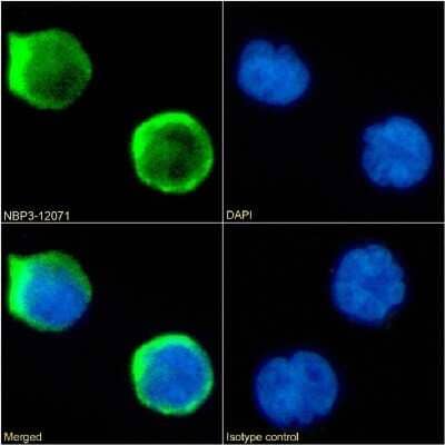 Immunocytochemistry/Immunofluorescence: CD1a Antibody (CBT6) - Chimeric [NBP3-12071] - Immunofluorescence analysis of paraformaldehyde fixed Jurkat cells on Shi-fix(TM) coverslips stained with the chimeric rabbit IgG version of CBT6 (NBP3-12071) at 10 ug/ml for 1h followed by Alexa Fluor(R) 488 secondary antibody (2 ug/ml), showing membrane staining. The nuclear stain is DAPI (blue). Panels show from left-right, top-bottom NBP3-12071, DAPI, merged channels and an isotype control. The isotype control was an unknown specificity antibody followed by staining with Alexa Fluor(R) 488 secondary antibody.