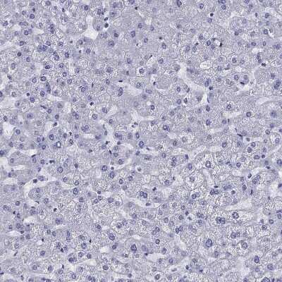 Immunohistochemistry-Paraffin: CD1a Antibody [NBP1-86560] - Staining of human liver shows no positivity in hepatocytes as expected.