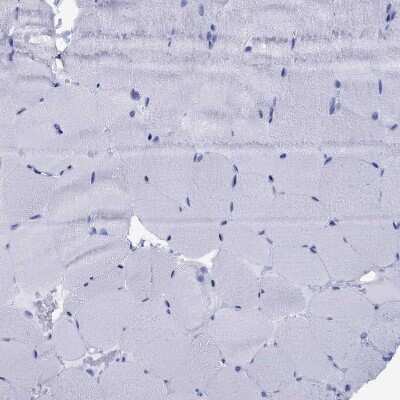 Immunohistochemistry-Paraffin: CD1a Antibody [NBP1-86560] - Staining of human skeletal muscle shows no positivity in myocytes as expected.