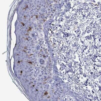 Immunohistochemistry-Paraffin: CD1a Antibody [NBP1-86560] - Staining of human skin shows strong granular cytoplasmic positivity in Langerhans cells.